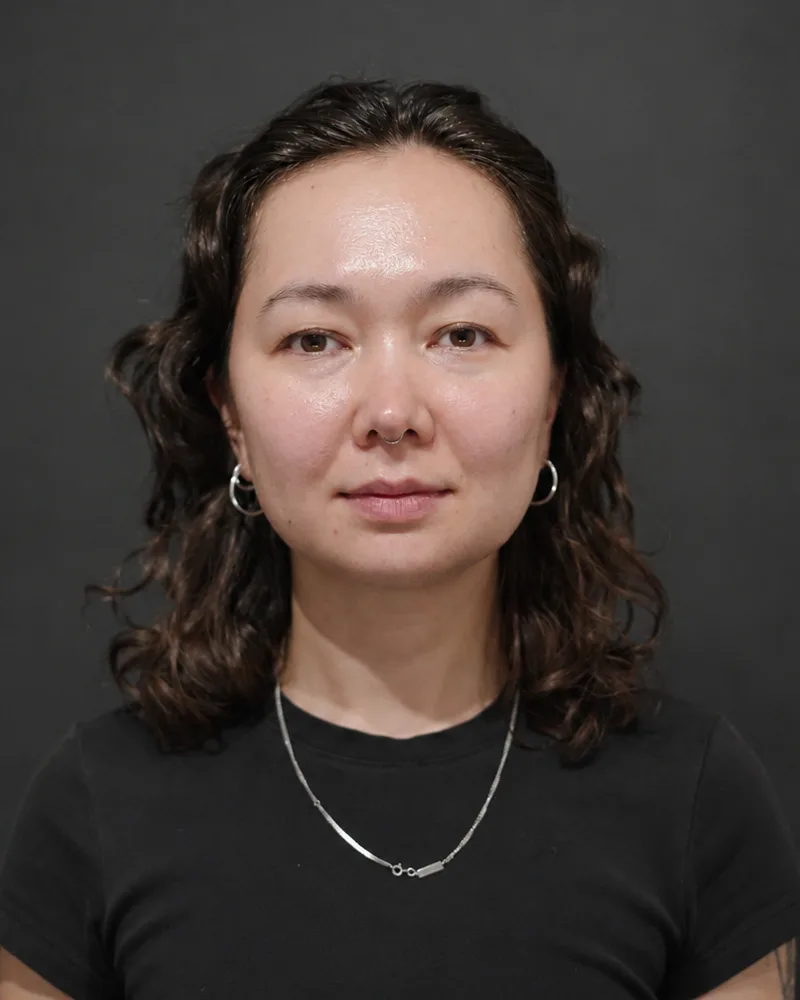 Patient two after treatment, facing the camera